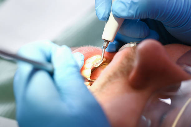 Best Emergency Dental Services for Seniors in Hemphill, TX