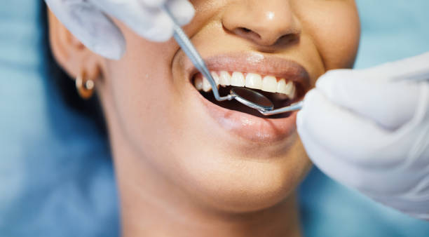 Best Orthodontic Emergency Dentist in Hemphill, TX