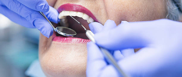 Best Emergency Dentist for Lost Fillings or Crowns in Hemphill, TX
